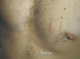 Sexto